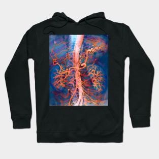 Abdominal arteries, X-ray (P206/0309) Hoodie